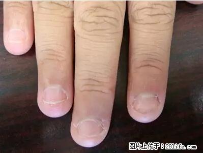 剪指甲、挖耳屎，这些日常小动作竟隐藏大危害！ - 盐城生活资讯 - 盐城28生活网 yancheng.28life.com
